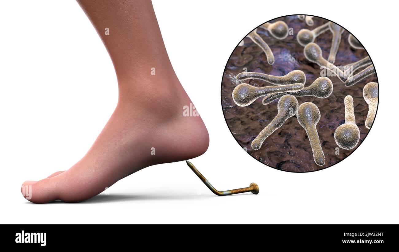 Infection transmission. Conceptual illustration showing an old rusty ...
