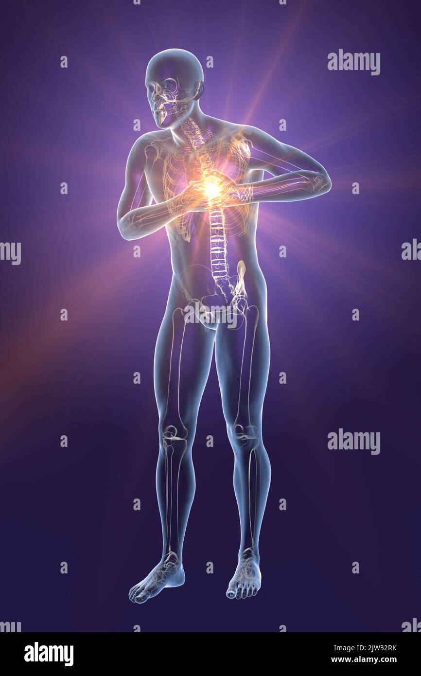 Man with chest pain, illustration Stock Photo Alamy