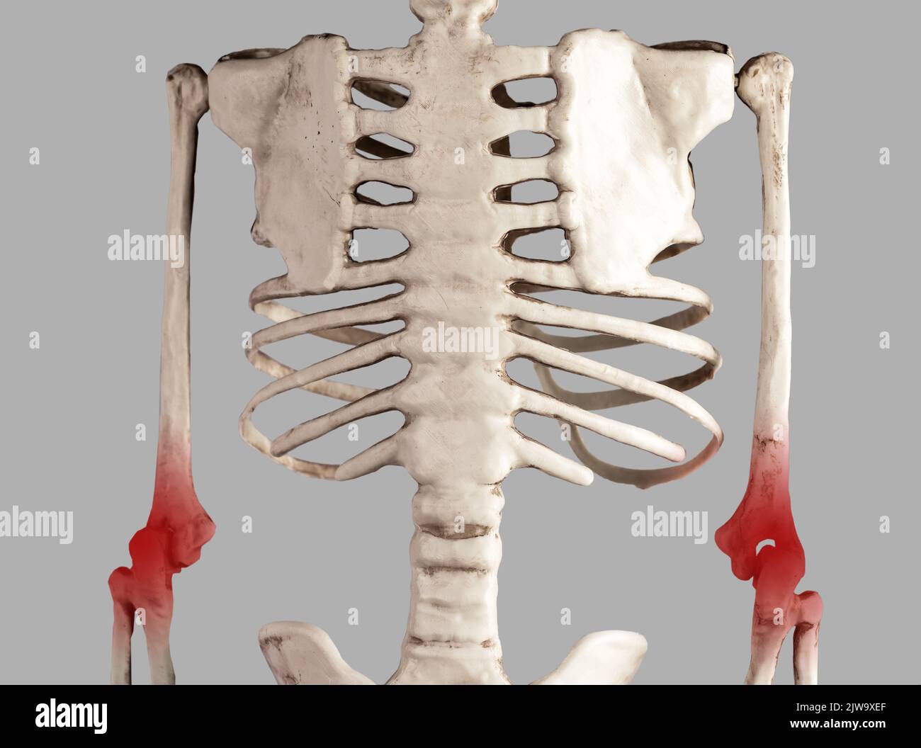 Skeleton with elbows joints pain, ache, hurt. Orthopedic concept. High
