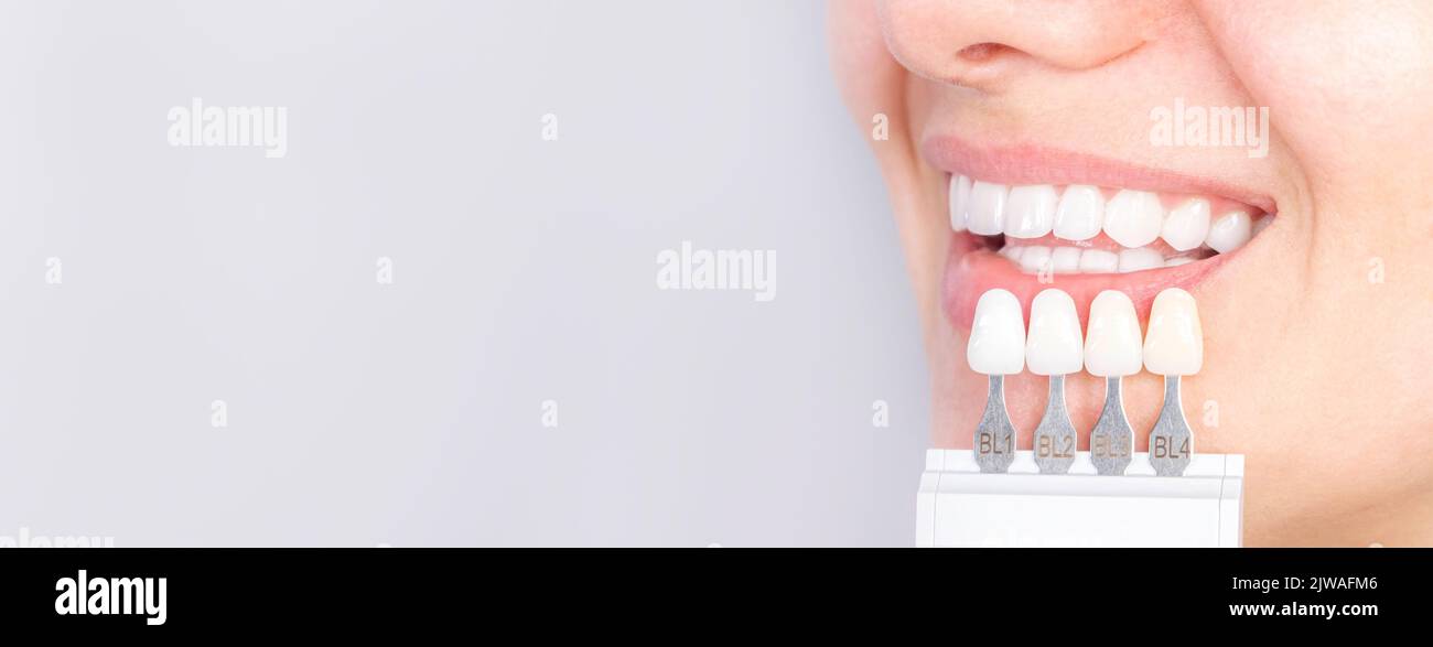 Banner tooth whitening, perfect white teeth close up with shade guide