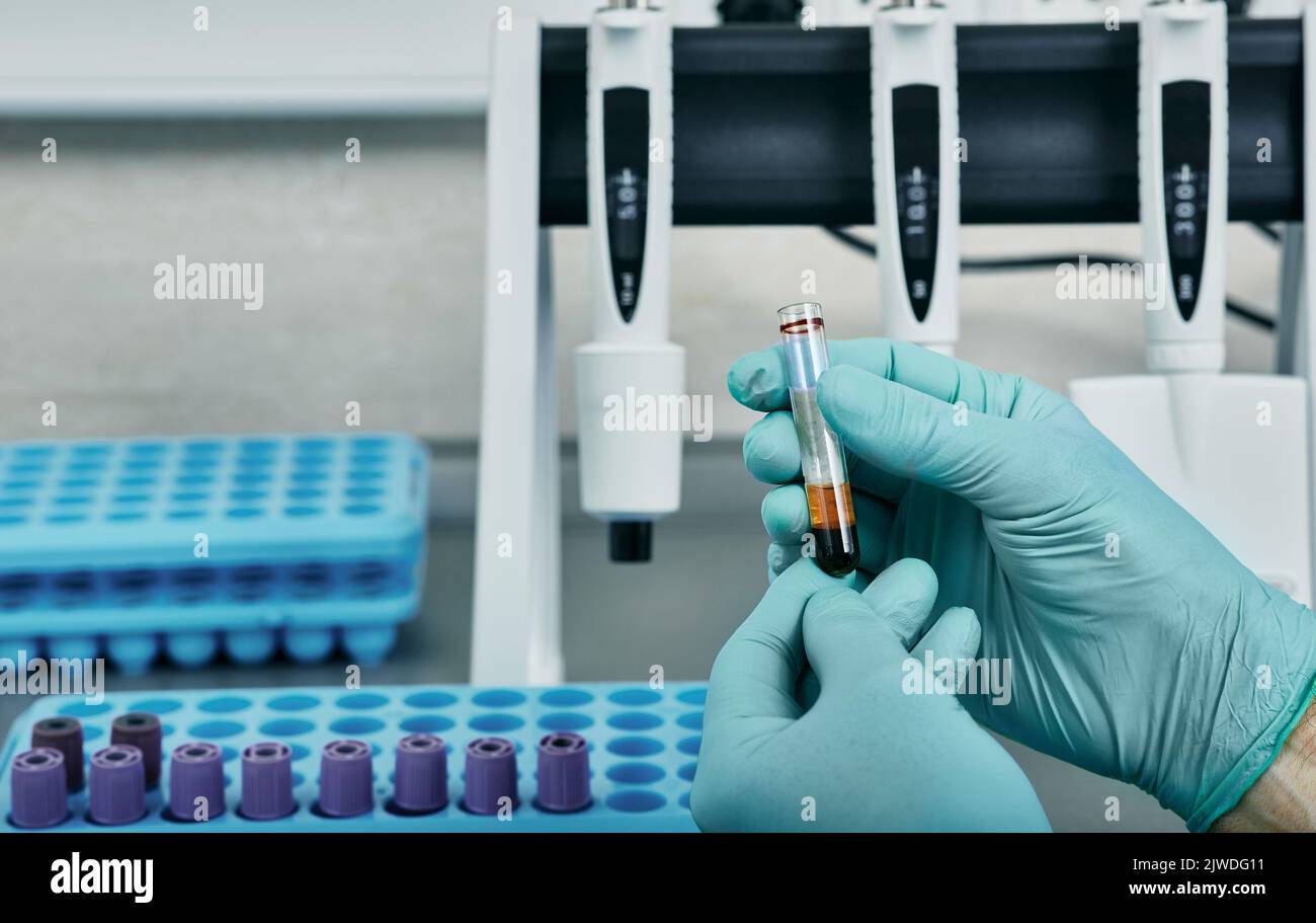 Blood sample in test tube in hands of laboratory assistant during