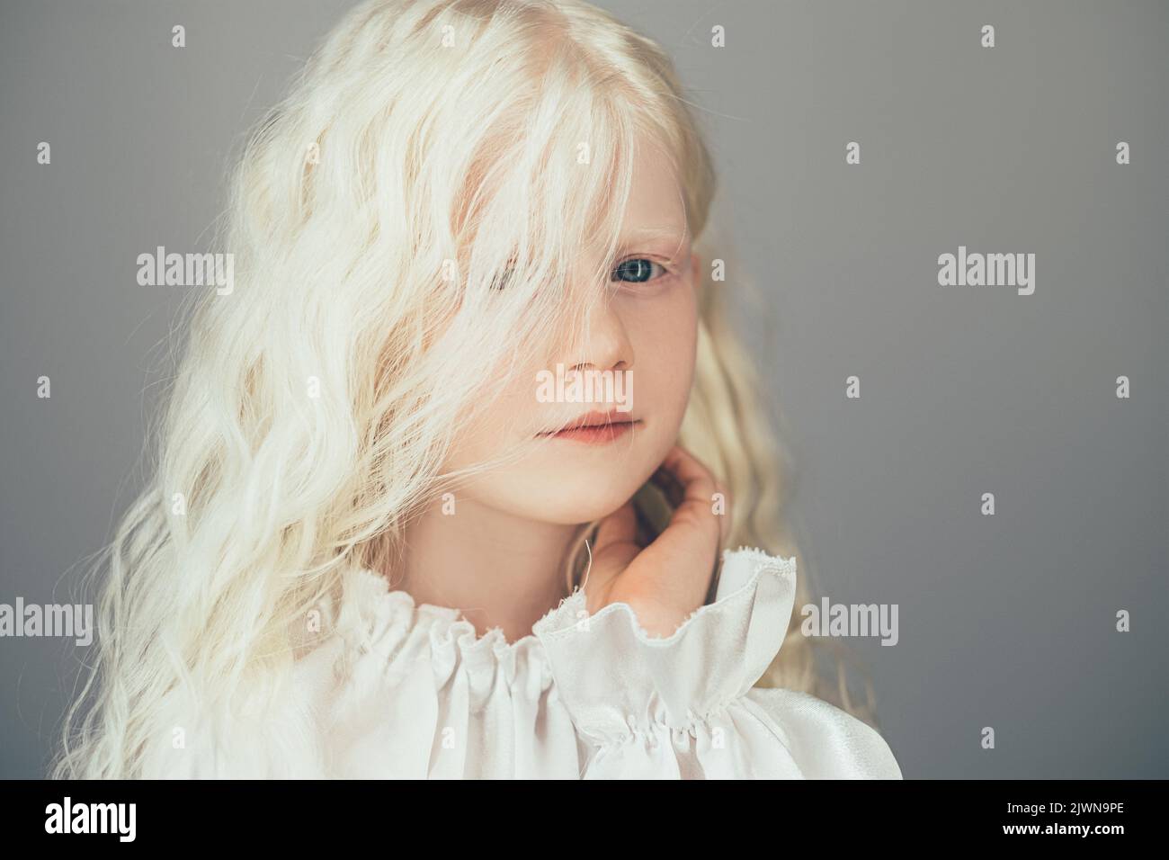 Albino girl hi-res stock photography and images - Alamy