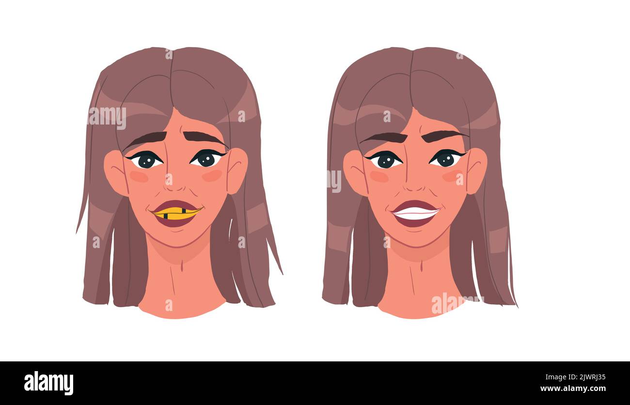 Cute cartoon Girl Before And After Dental Teeth Braces Correction Stock Vector