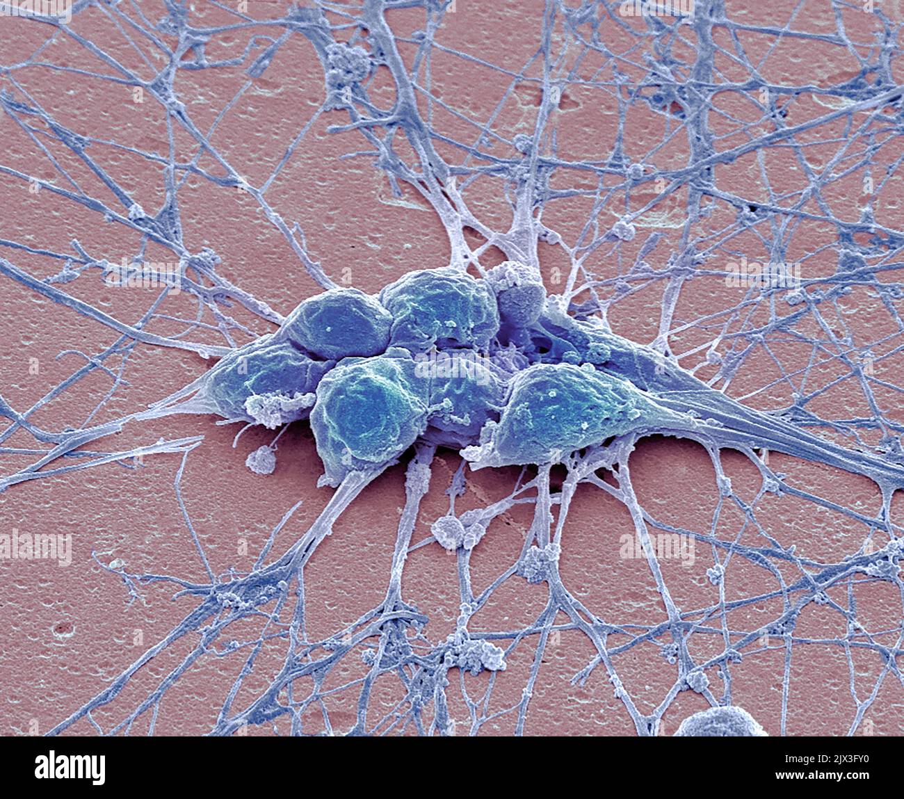 Ngn2 Neurones. Coloured scanning electron micrograph (SEM). Human neurons ...