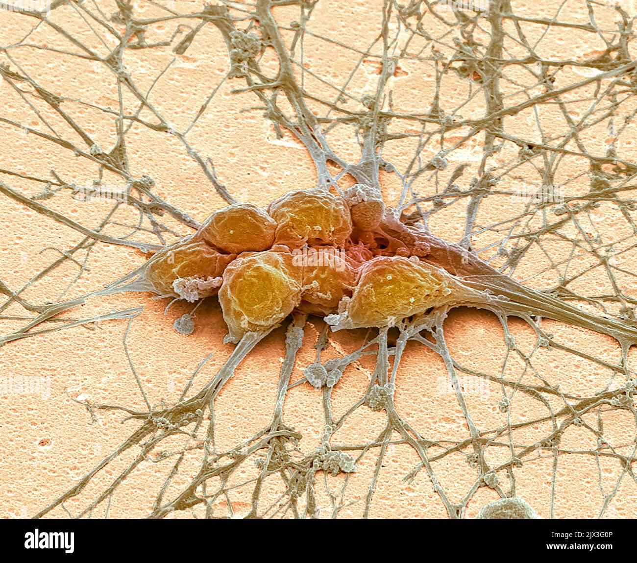 Ngn2 Neurones. Coloured scanning electron micrograph (SEM). Human neurons ...