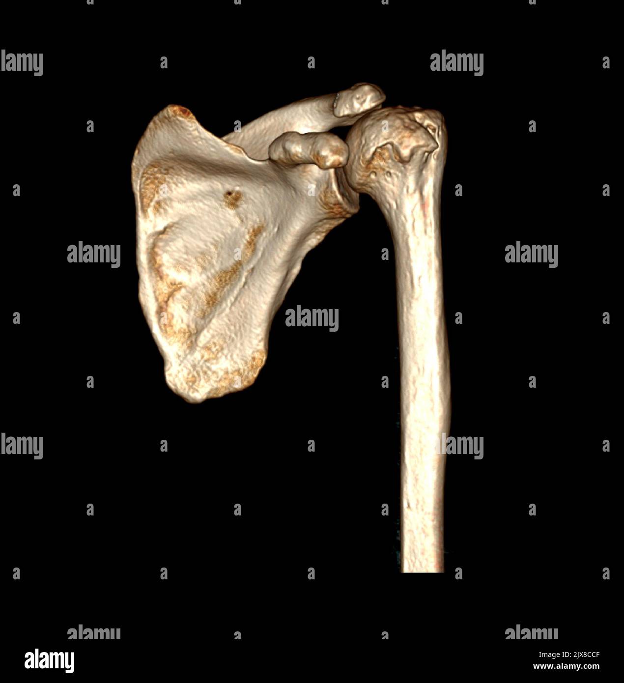 Computed Tomography Volume Rendering examination of the Shoulder 3D ...