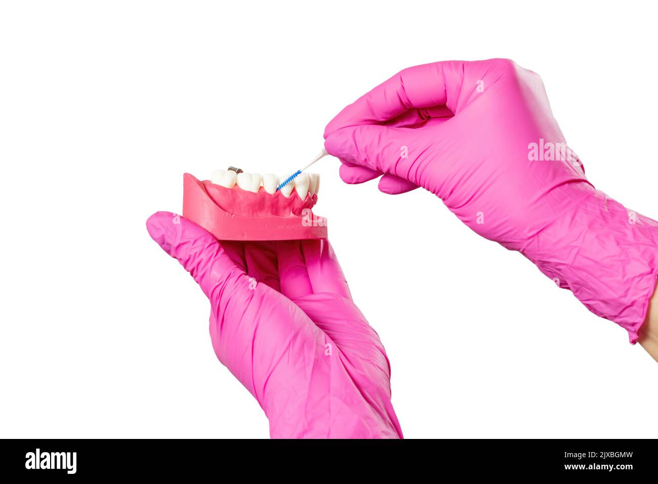 Close-up view of dentist's hands with the human jaw layout and the ...