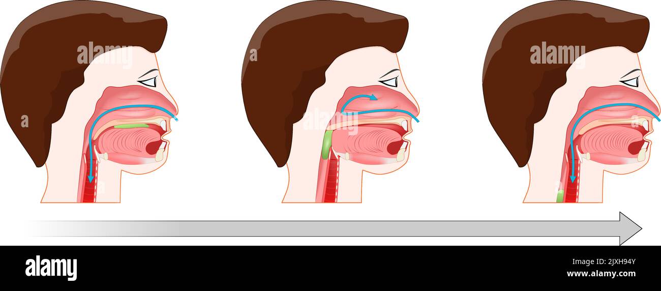 Swallowing. Process of deglutition. After form the bolus, food is ready to be swallowed. The soft palate elevated to close the nasopharynx, Epiglottis Stock Vector
