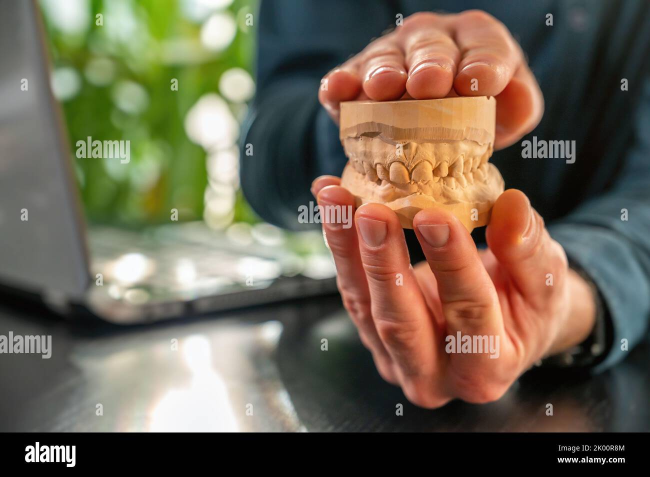 Dentist explains dental treatment with the help of a dental impression Stock Photo