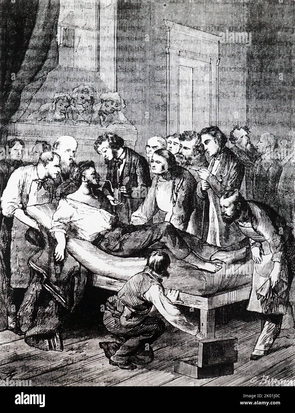 William Morton demonstrating the safety of ether. Massechusettes General Hospital, 1846. From Louis Figuier Les Merveilles de la Science, Paris, nd. c1870. Stock Photo