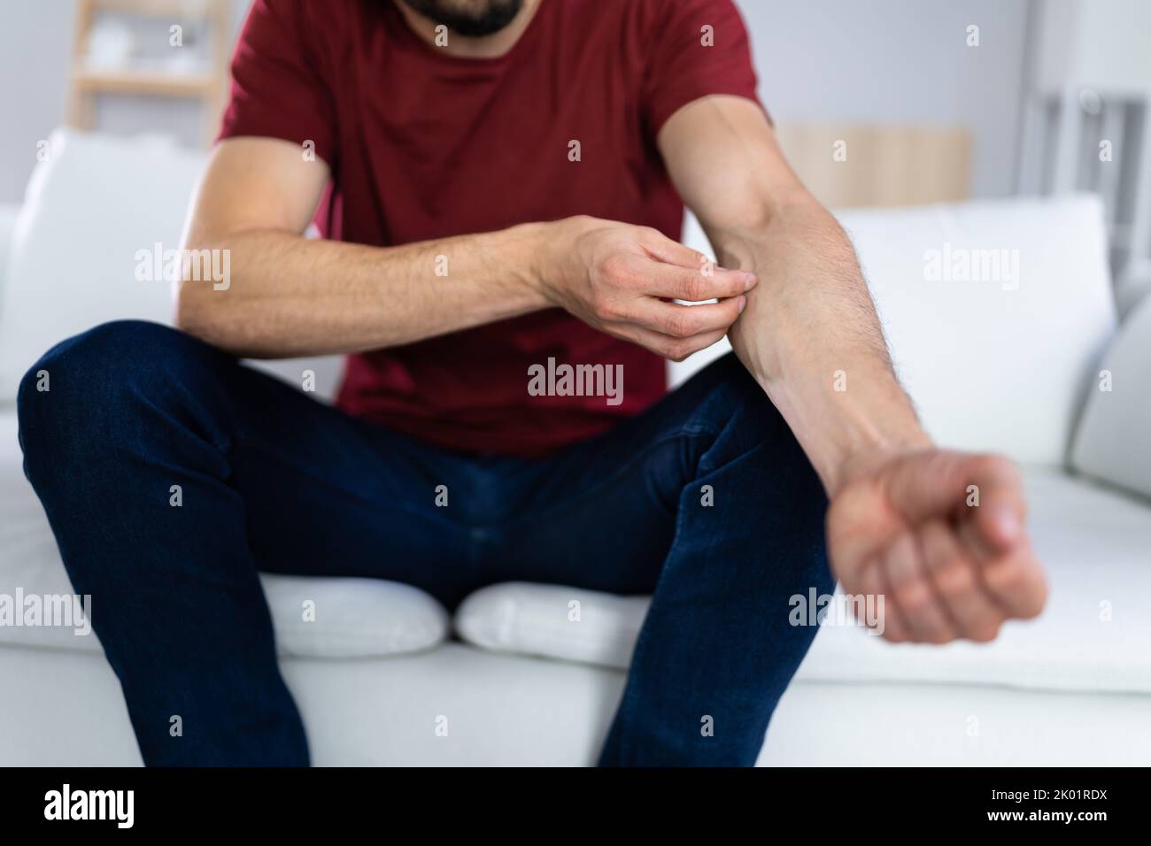 Man With Itchy Skin. Allergy Or Psoriasis Stock Photo