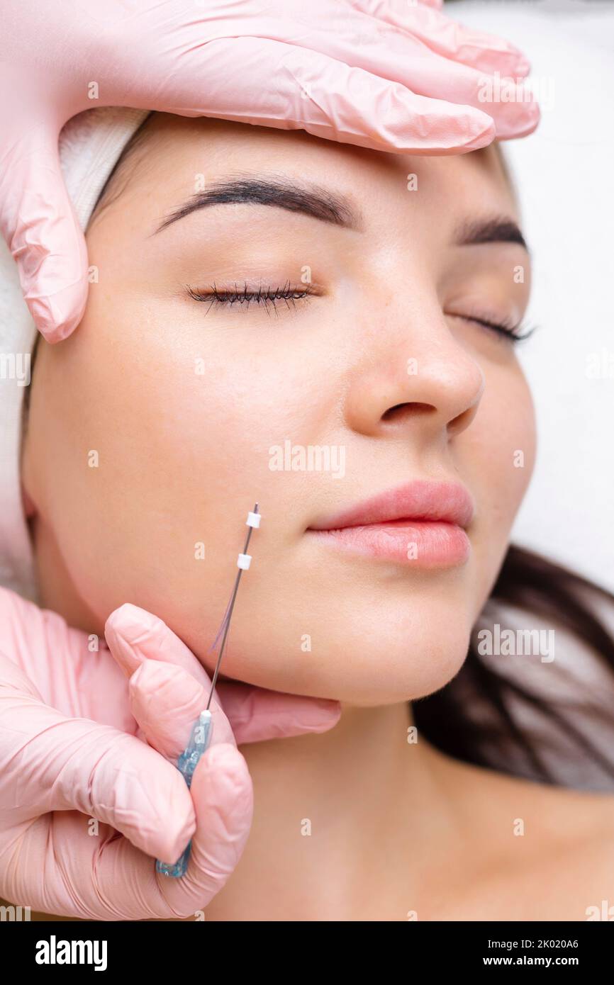 Face lifting PDO Suture operation. innovative technique of New thread