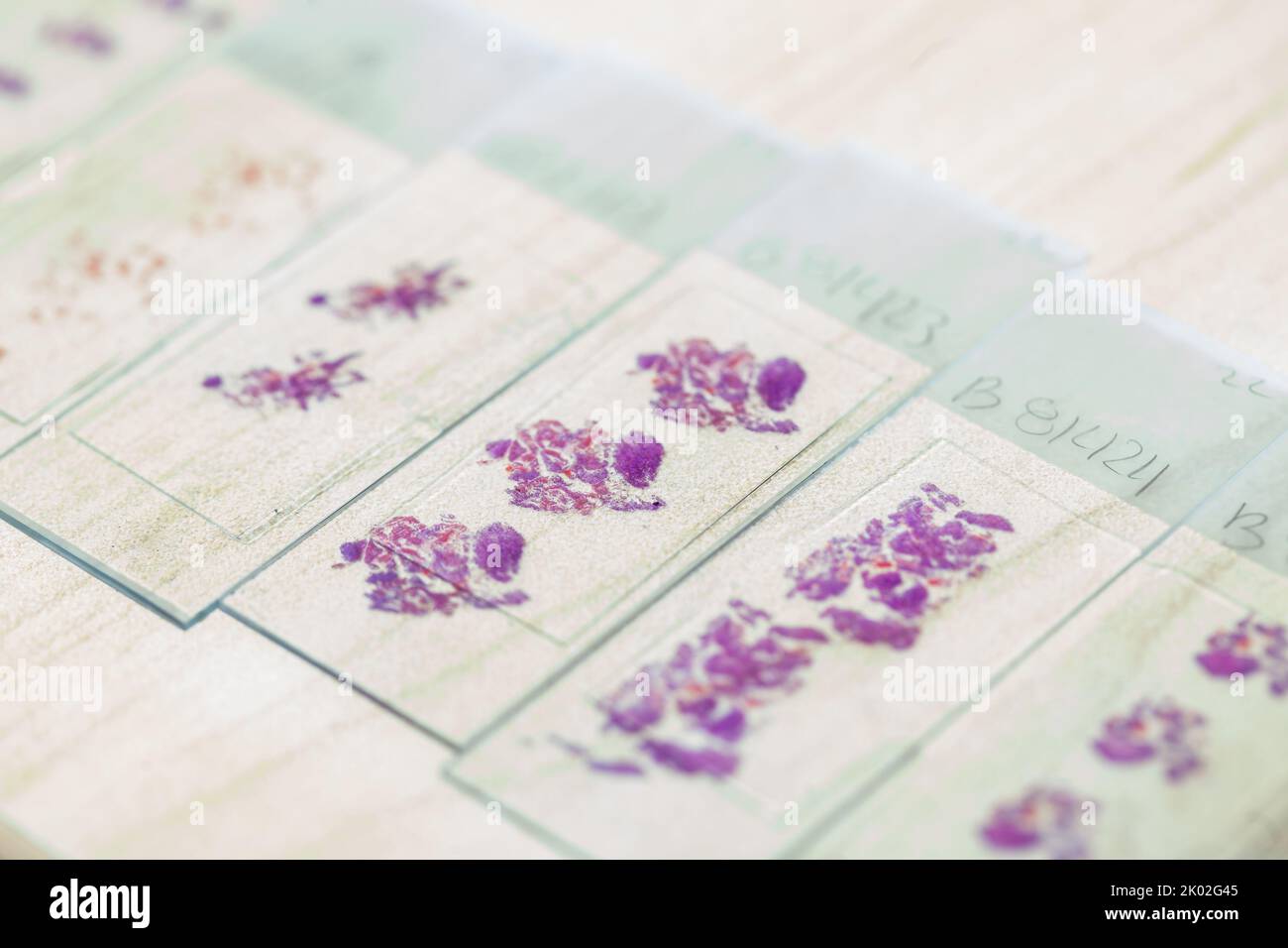 Stained tissue biopsy on glass slides in pathology laboratory Stock Photo Alamy