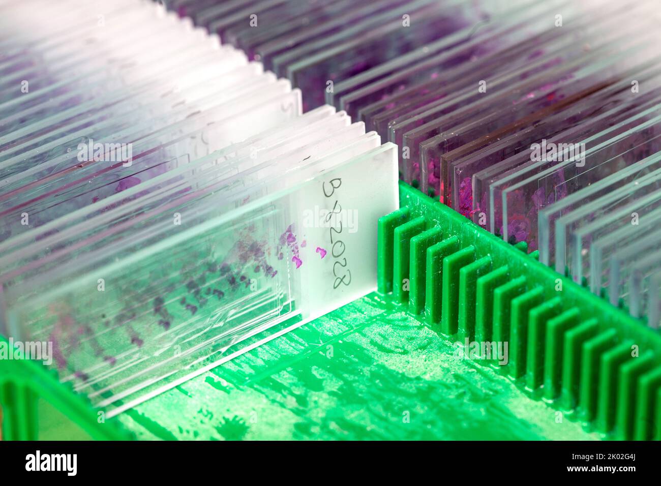 Box of stained tissue biopsy glass slides in pathology laboratory Stock