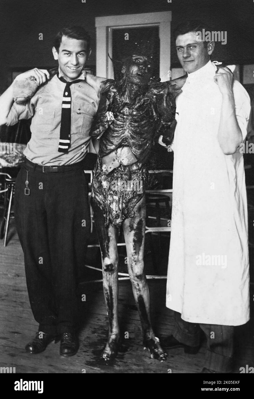 Two medical school students at the University of Wisconsin at Madison playfully hold up a cadaver for a portrait, circa 1908. Stock Photo