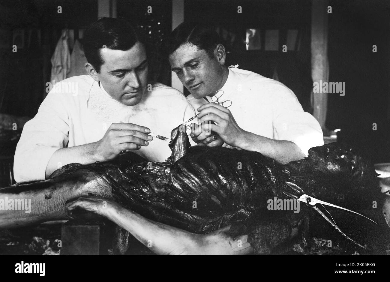 Two medical students at the University of Wisconsin examine a cadaver in  the course of their studies, circa 1908. Stock Photo