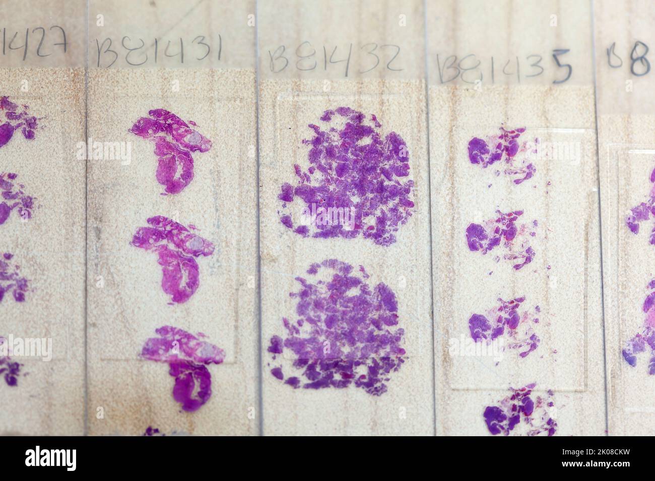Stained tissue biopsy on glass slides in pathology laboratory Stock Photo Alamy