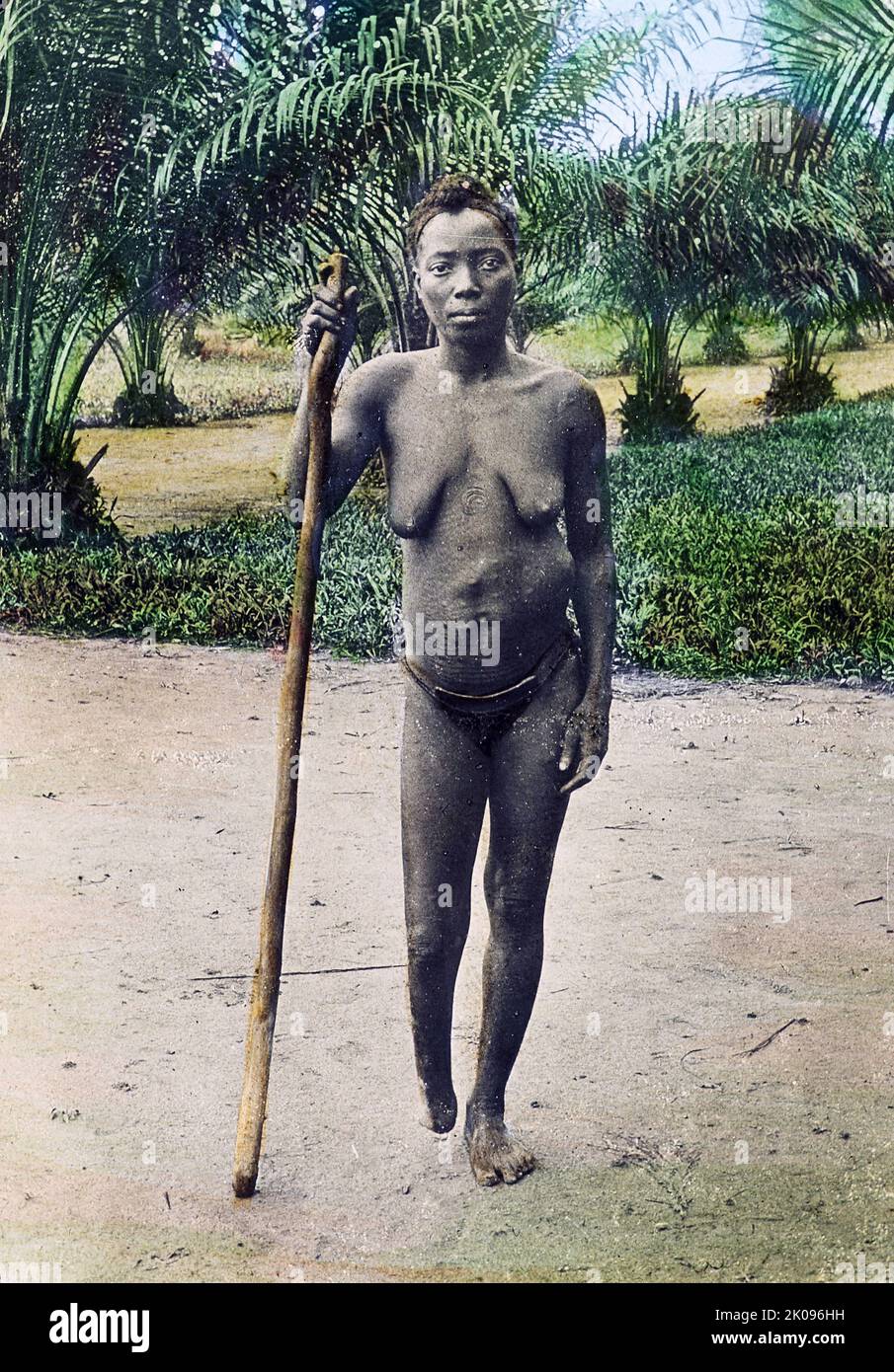 King Leopold II of Belgium's administration of the Congo Free State was characterised by atrocities, including torture and murder, resulting from notorious systematic brutality. The hands of men, women, and children were amputated when the quota of rubber was not met and millions of the Congolese people died. Stock Photo