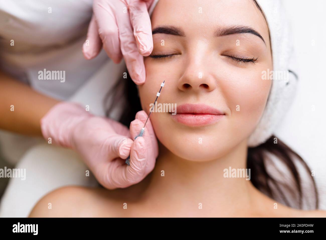 Face lifting PDO Suture operation. innovative technique of New thread ...