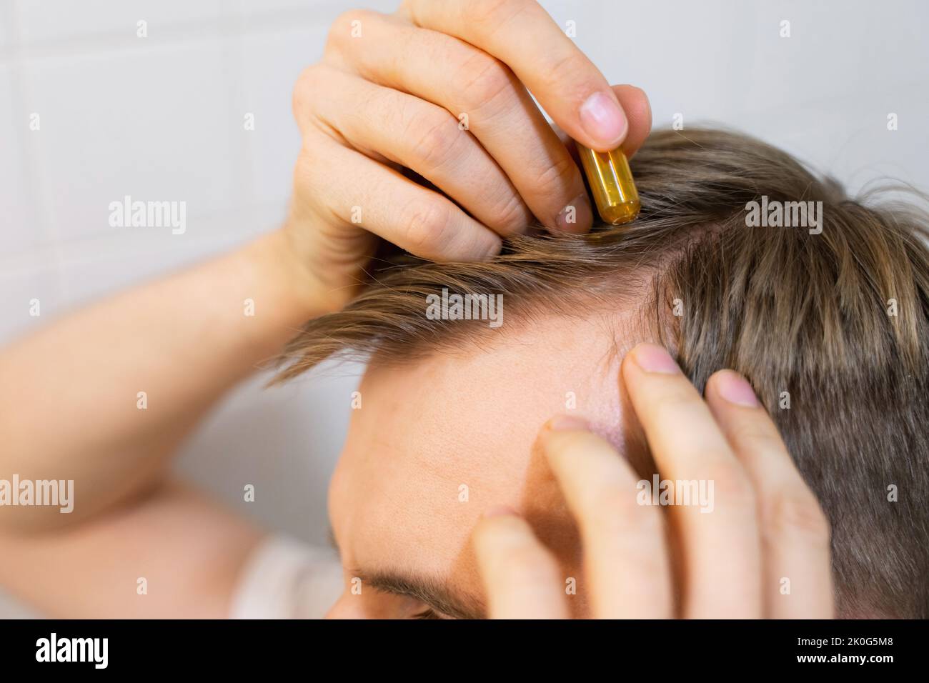 Middle aged caucasian white man uses, applies to hair with cosmetic ampoules with serum for hair growth, restoration beauty hair. The concept Stock Photo