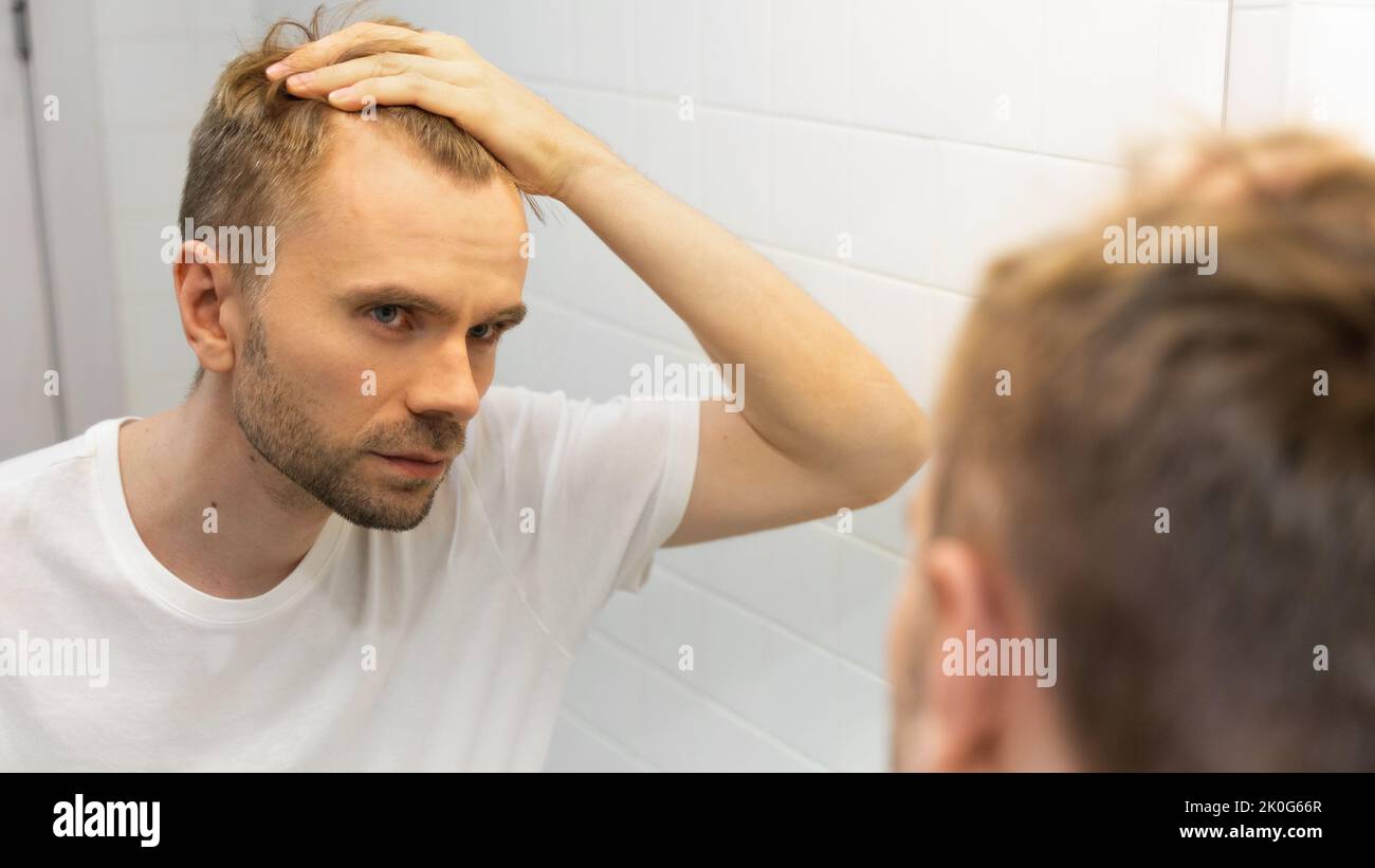 Middle aged caucasian white man with a short beard looks at his hair in the mirror in the bathroom and worried about balding. The concept Stock Photo