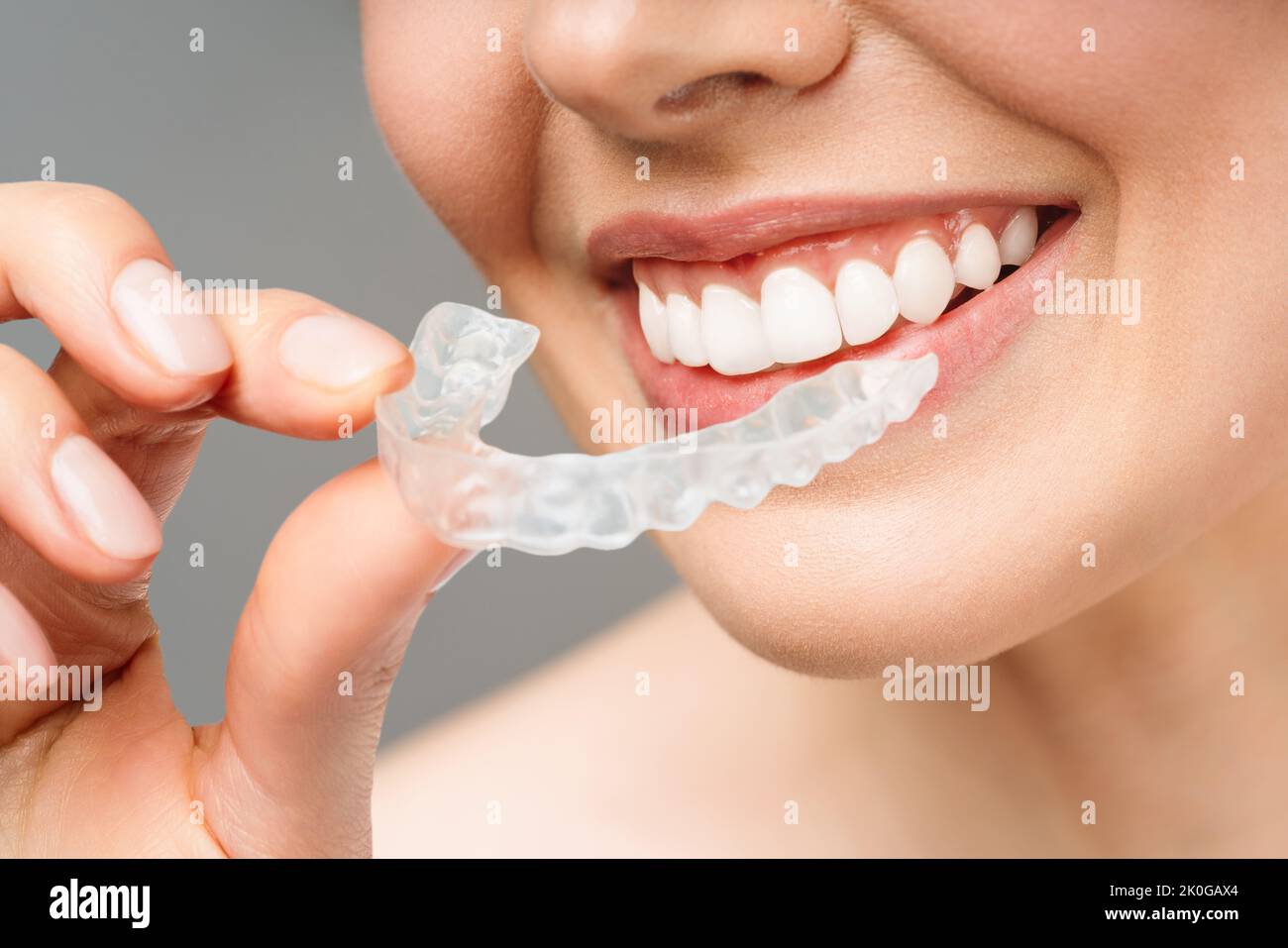 The woman holds in her hand removable invisible transparent aligners, and smiles. Stock Photo