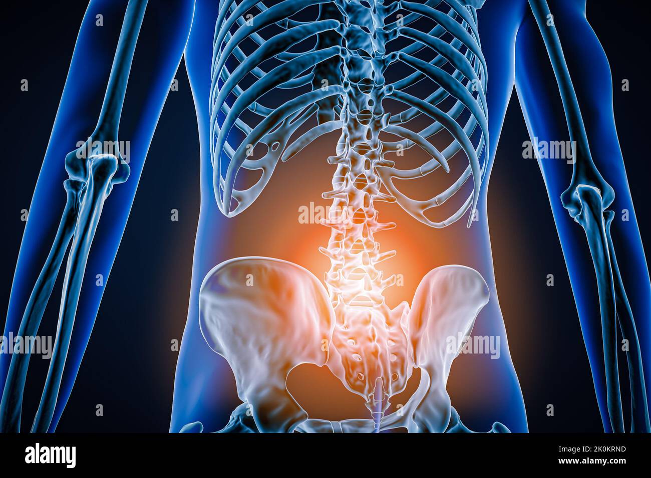 Posterior or back view of human spine or spinal column with inflammation or injury 3D rendering illustration. Pathology, backbone pain, anatomy, lumba Stock Photo