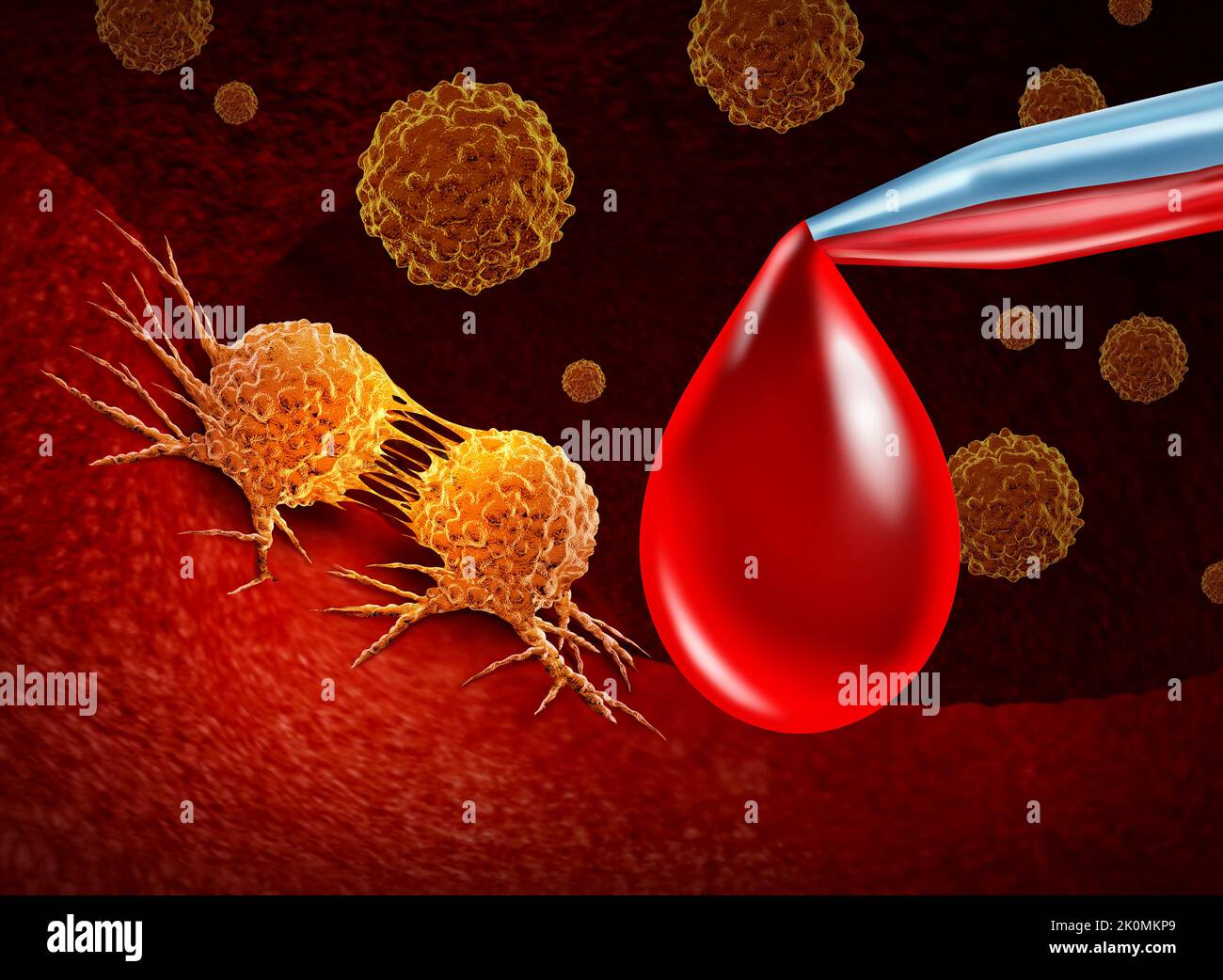 Cancer screening and blood test for early detection of malignant cells in a human body caused by carcinogens and genetics with a cancerous cell. Stock Photo