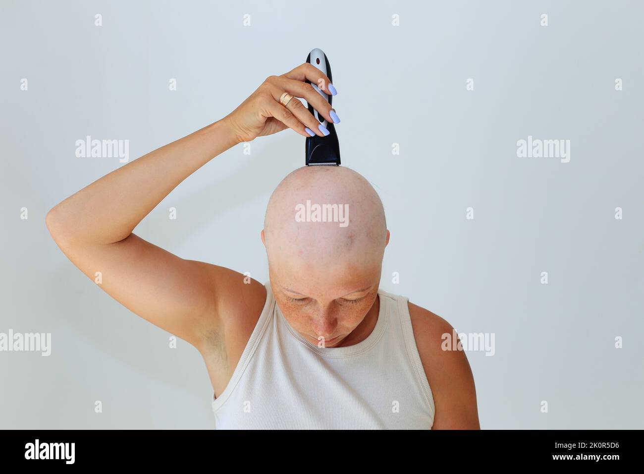 consequences of chemotherapy. Shaving off the last hair on the head