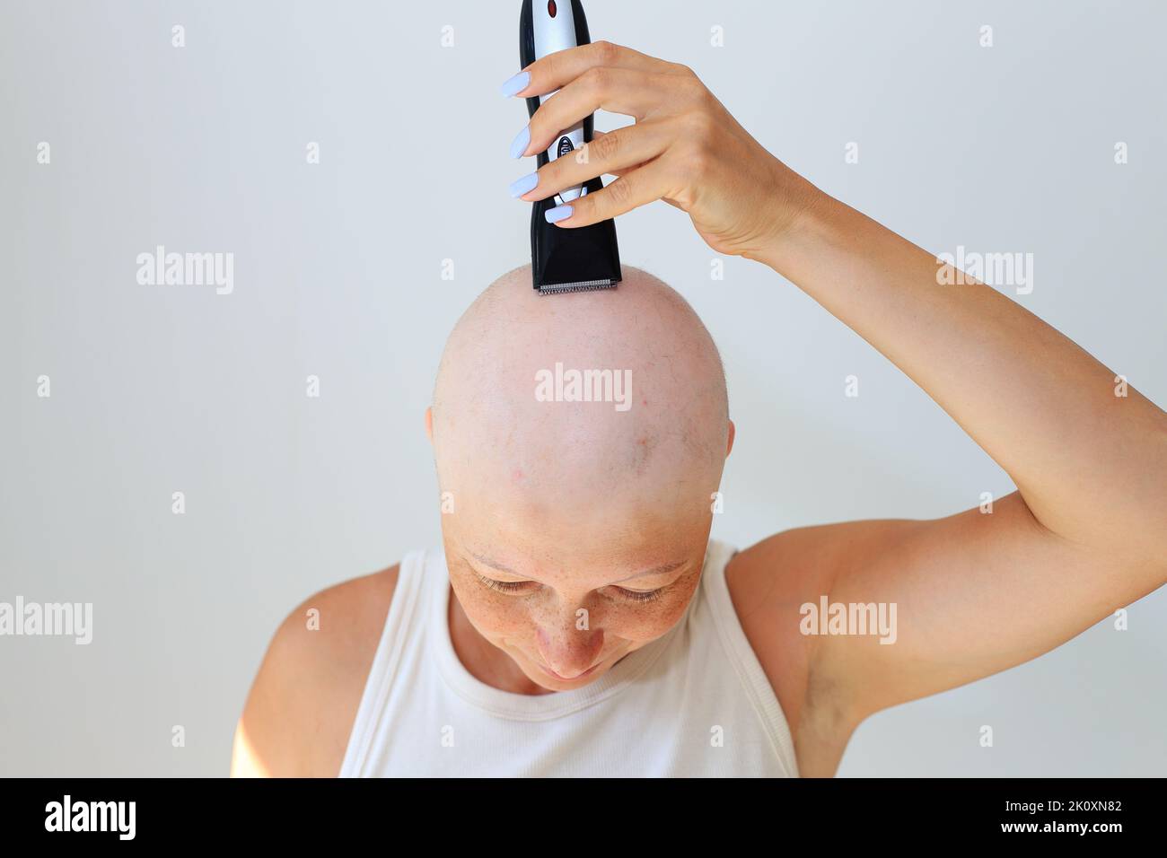 consequences of chemotherapy. Shaving off the last hair on the head with a razor. Head and razor. Total alopecia in a woman. Bald head. Hair in arms and bald head Stock Photo