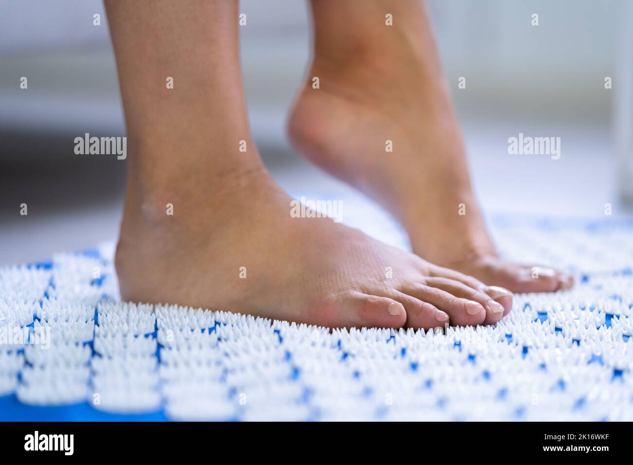 Acupuncture Points Medical Treatment For Woman. Needle Therapy Stock Photo