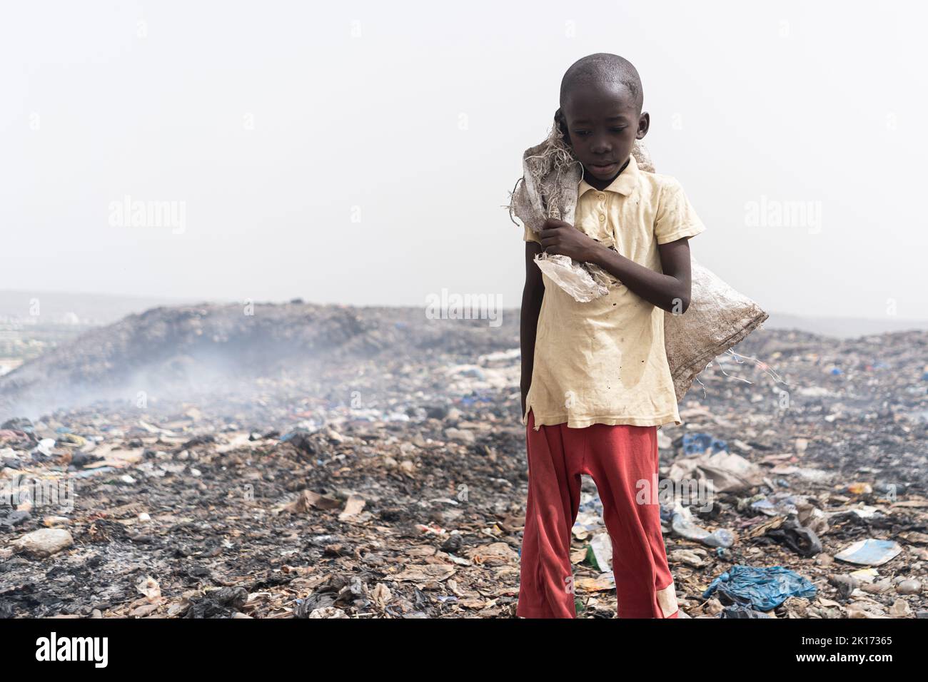 Neglected, malnourished African boy standing desolate in the midst of a smelly and smoking garbage dump; social issue of child abandon Stock Photo