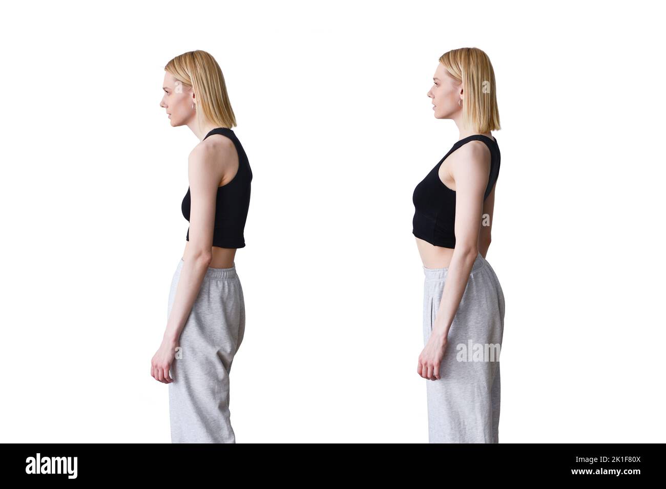 Woman with slouch and straight posture. Stock Photo