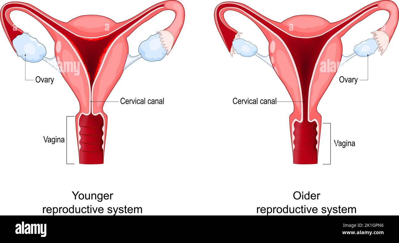 Menopause. Comparison and difference between Younger and older women uterus. Climacteric changes in the vagina, ovary and cervix. female reproductive Stock Vector