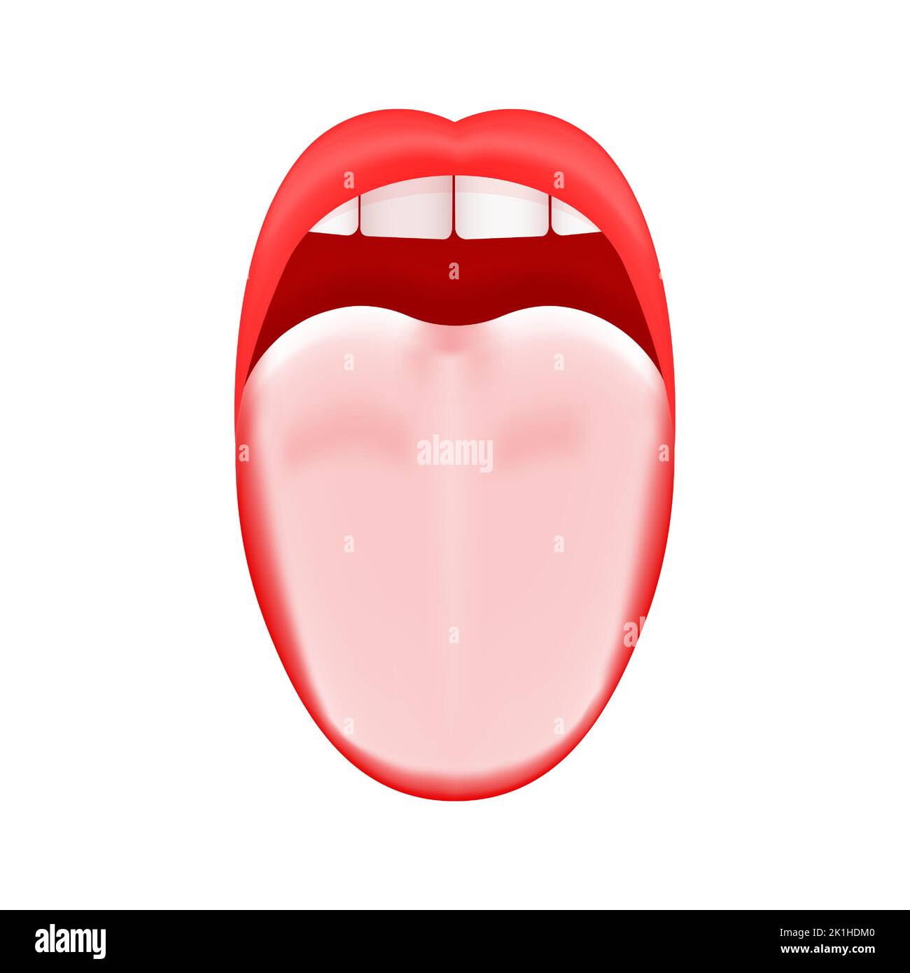White or coated tongue. Dry mouth. Open human taste organ with symptoms of stomatitis, candidiasis or glossitis bacterial infection isolated on white background. Vector realistic illustration Stock Vector