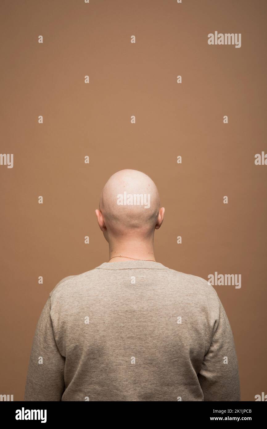 Portrait of bald woman with alopecia Stock Photo