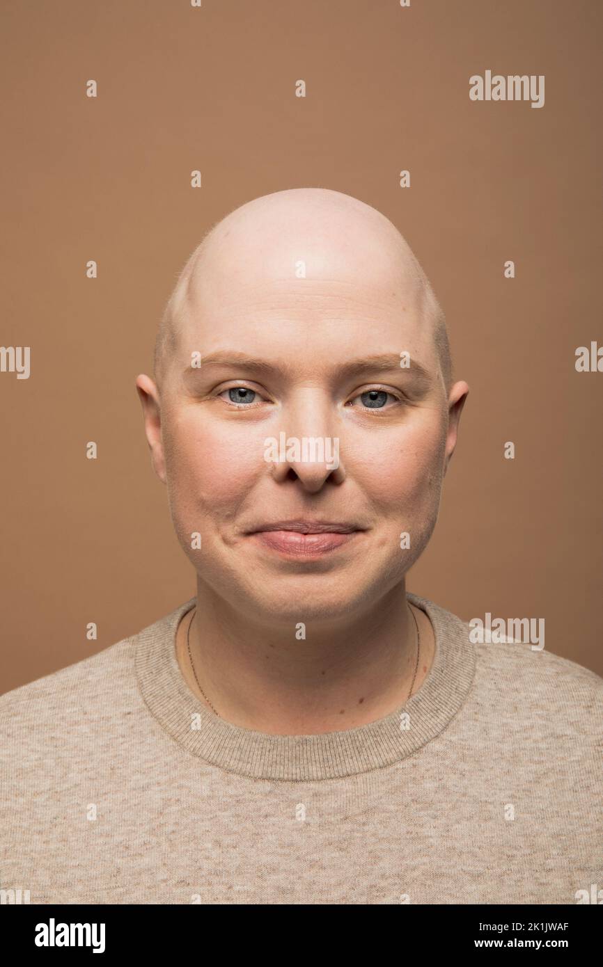 Portrait of confident bald woman with alopecia Stock Photo