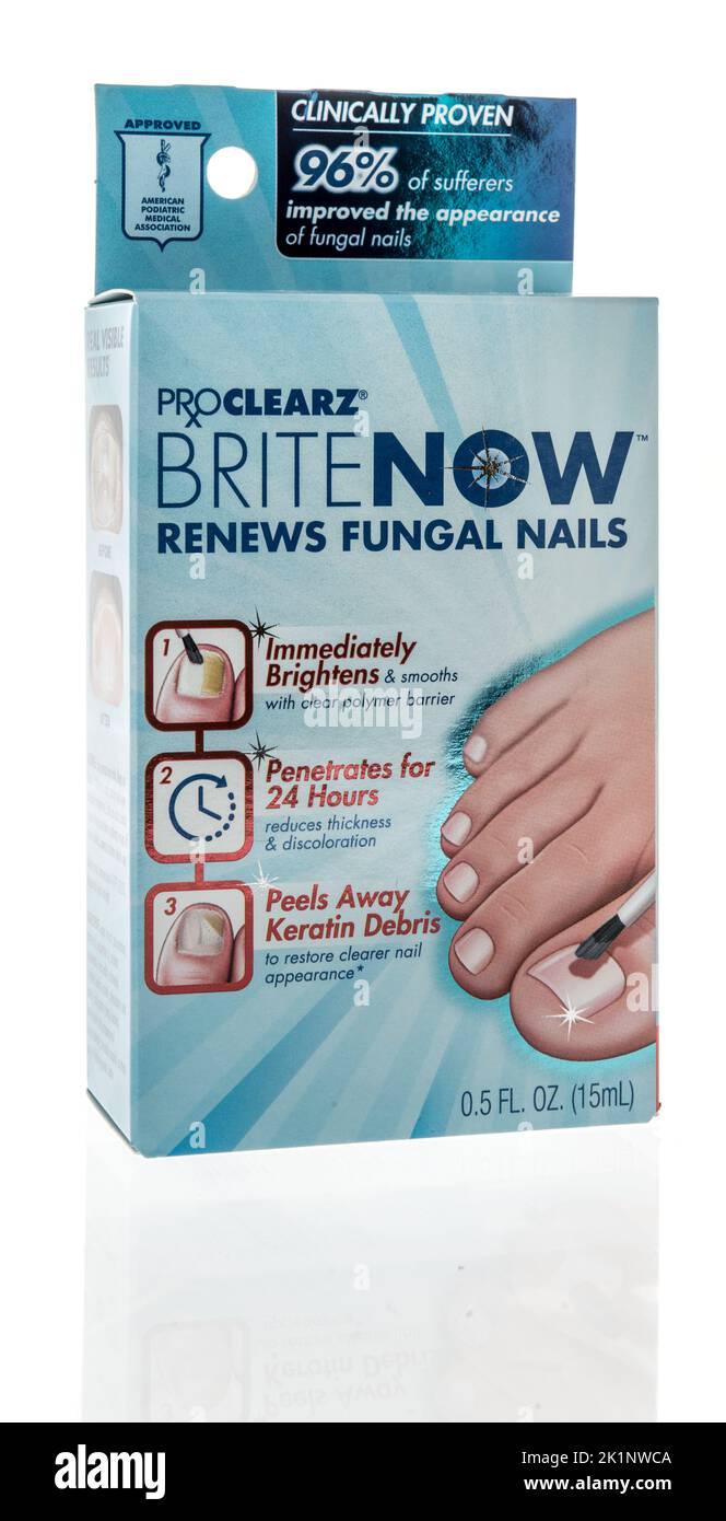 Winneconne, WI - 19 September 2022: A package of Proclearz brite now renews fungal nails on an isolated background. Stock Photo