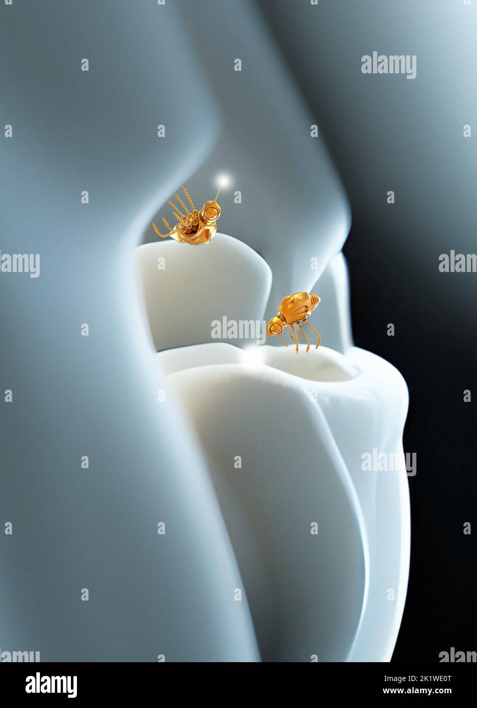 Nanorobots repairing tooth decay and cavities, illustration Stock Photo