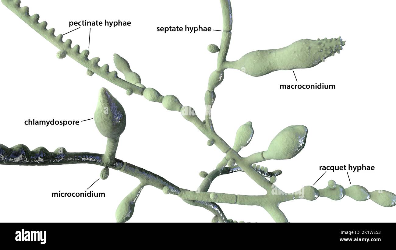 Microsporum audouinii fungus, illustration Stock Photo