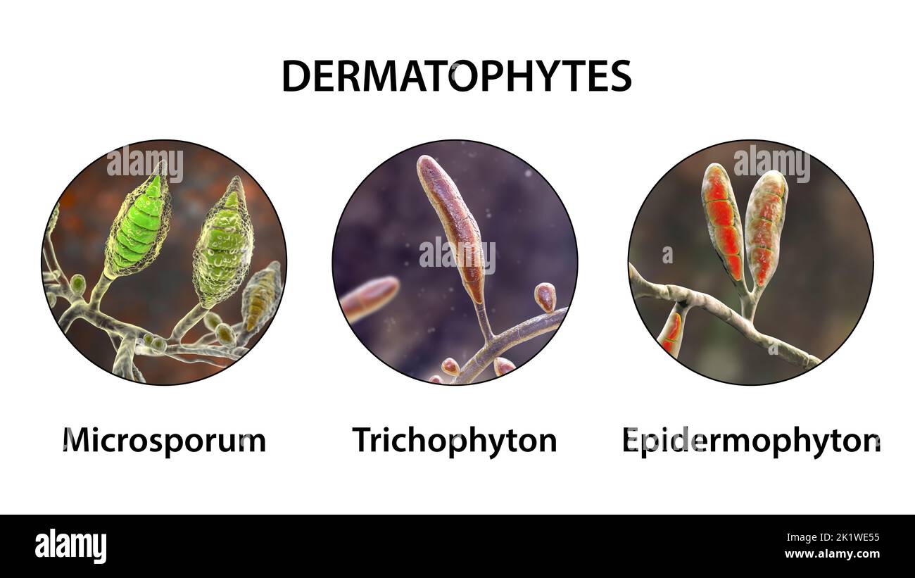 Dermatophyte fungi, illustration Stock Photo