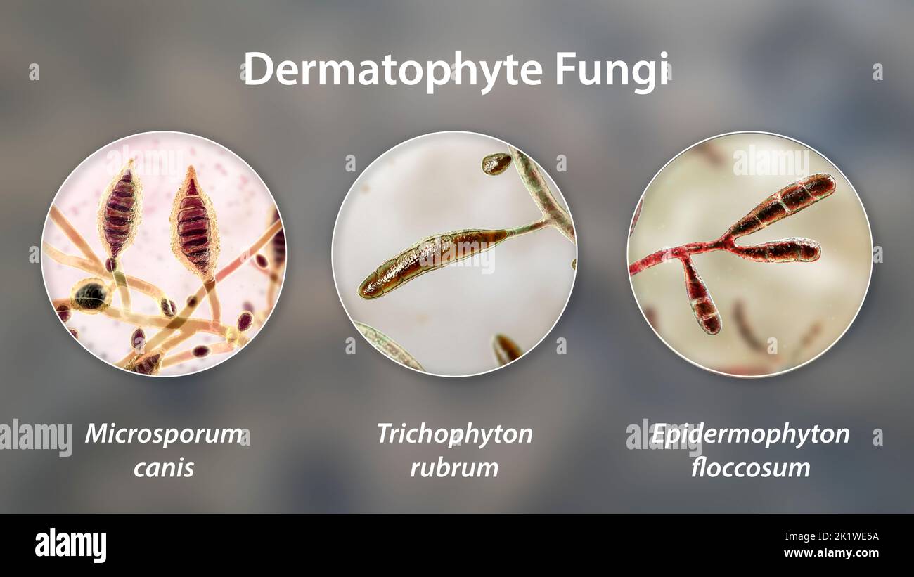 Dermatophyte fungi, illustration Stock Photo