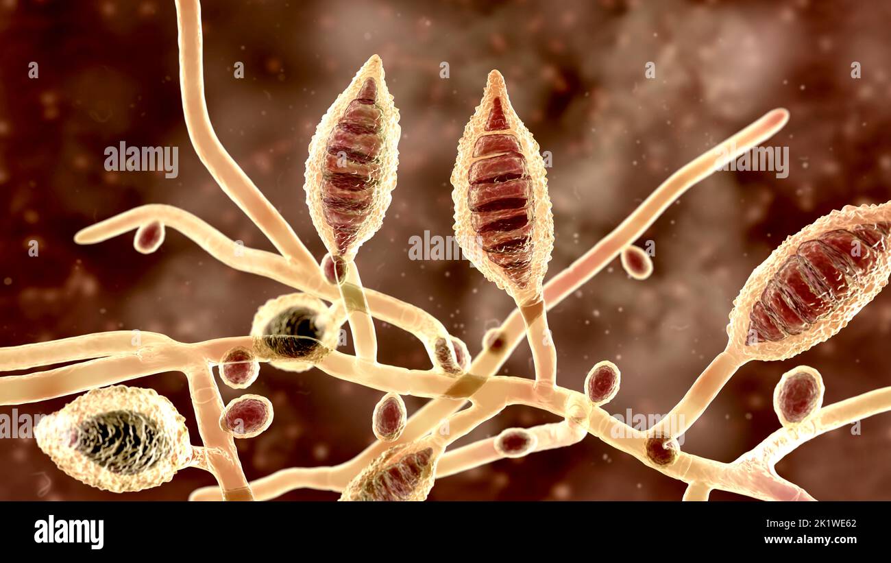 Microsporum canis fungus, illustration Stock Photo