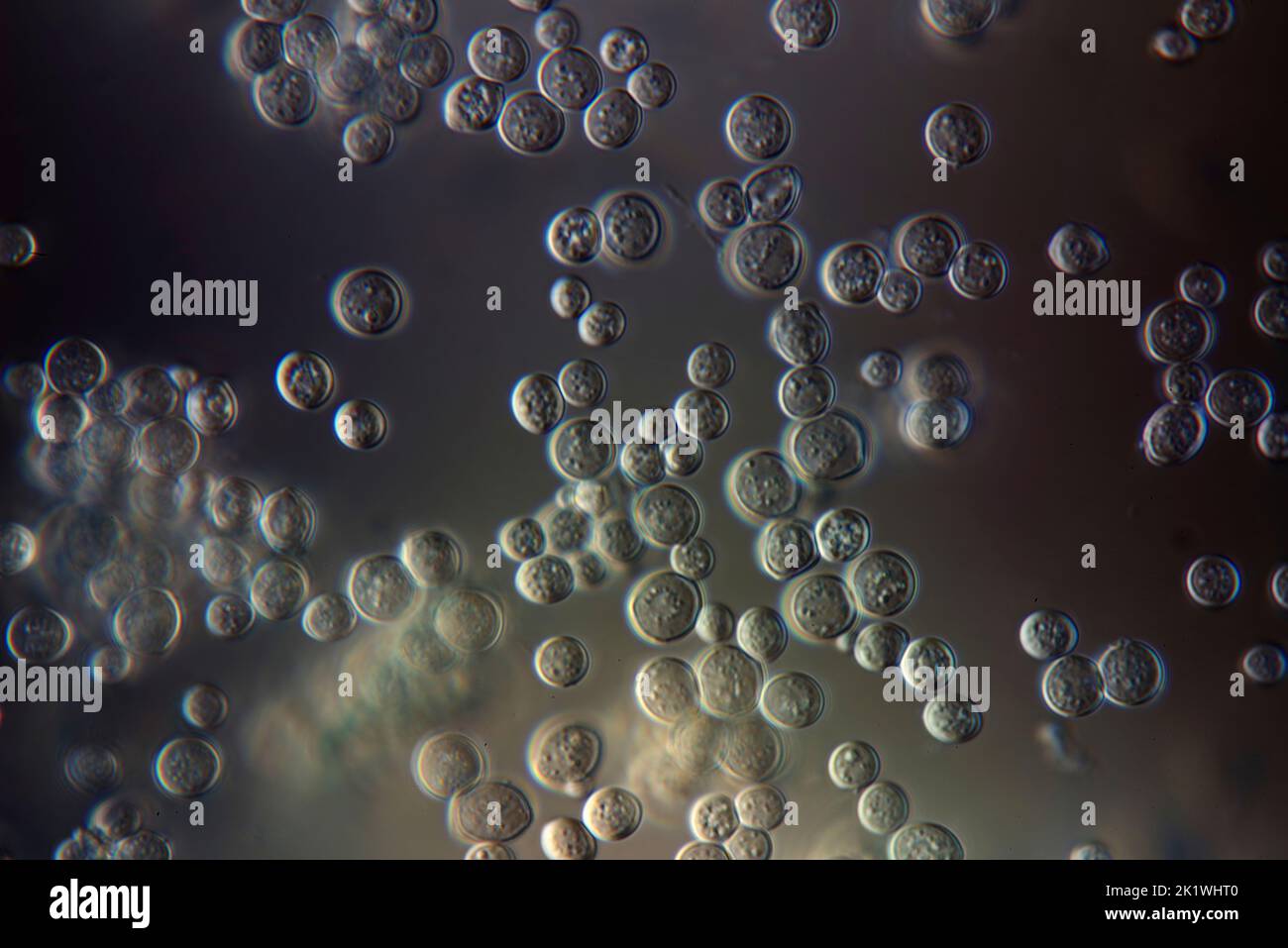 Yeast, light micrograph Stock Photo Alamy