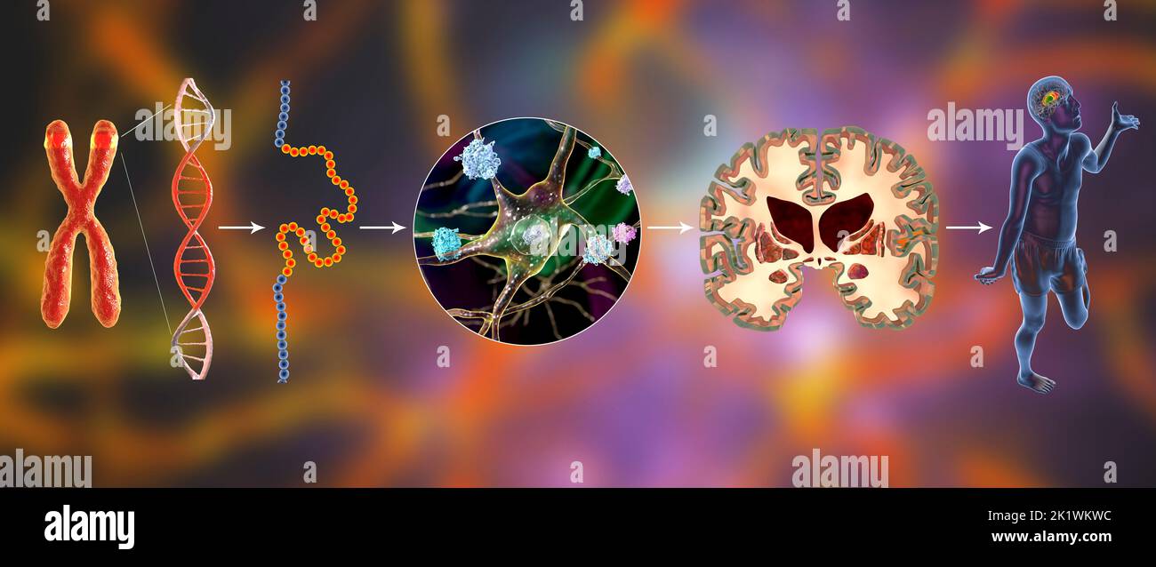 Molecular genesis of Huntington's disease, illustration Stock Photo