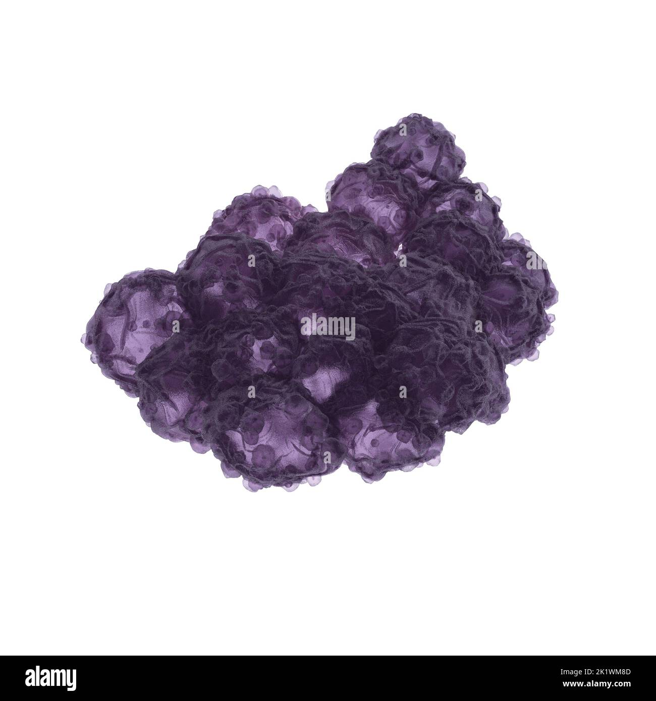 Necrotic tissue, illustration Stock Photo - Alamy
