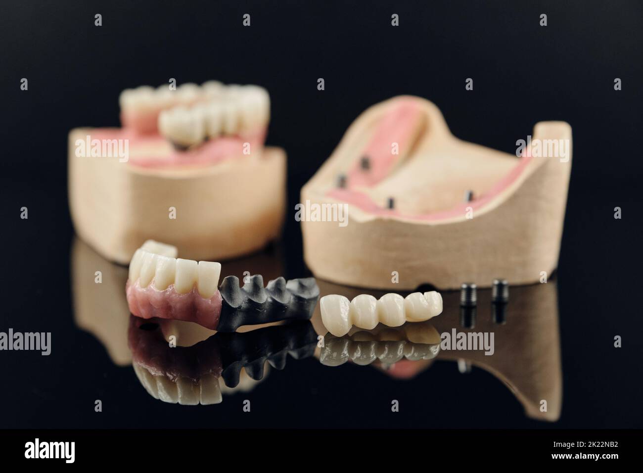 Composition of dental crowns and orthopedic components on a black