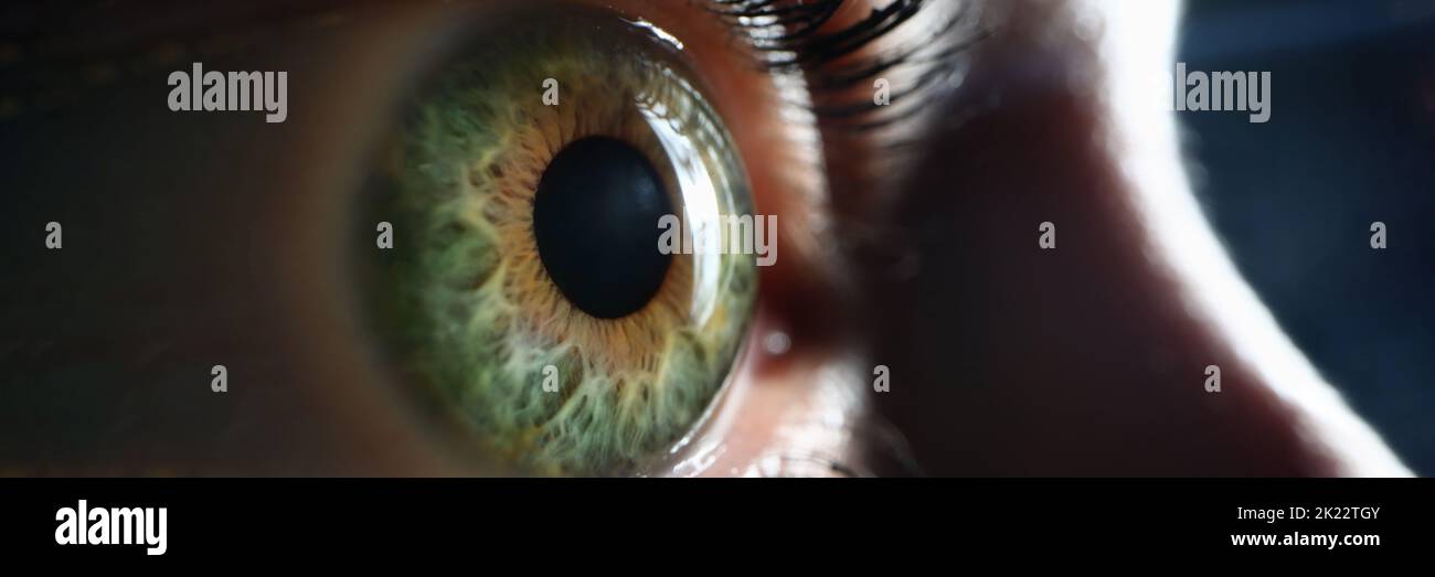 Female one green gray eye closeup. Farsightedness myopia Stock Photo