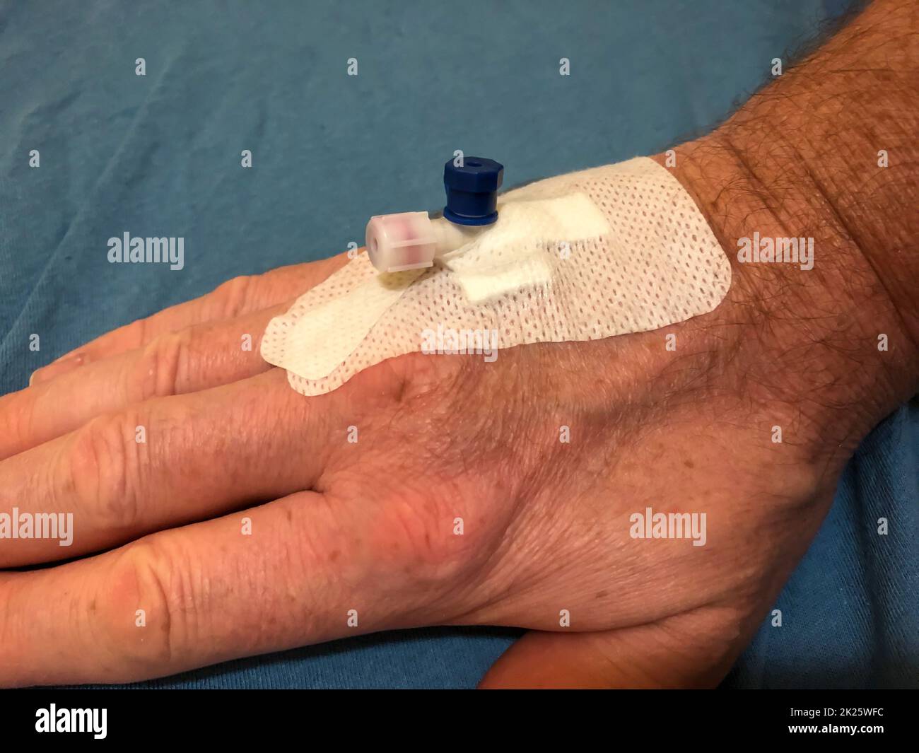 Cannula in hand patient hi-res stock photography and images - Alamy