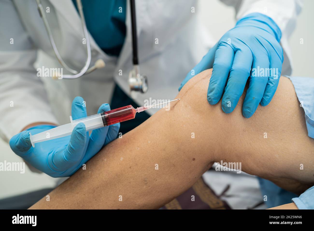 Asian doctor inject Hyaluronic acid platelet rich plasma into the knee of senior woman to walk